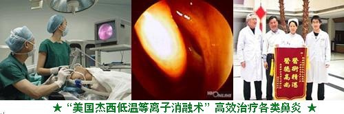 美国杰西低温等离子消融系统