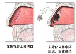 详细讲解射精障碍的三大护理方法