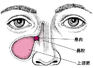 射精障碍