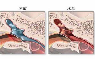 治疗尿道炎用什么方法最好