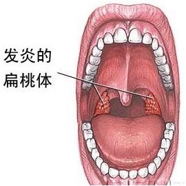 阴茎短小的治疗方法有哪些？