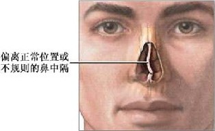 性欲障碍的症状表现