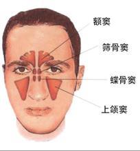 治过敏性阳痿要多少钱？
