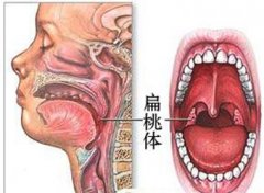 乌兰察布儿童阴茎短小的病因