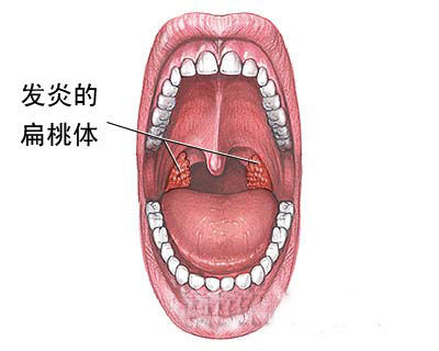 乌兰察布急性阴茎短小哪里治疗好